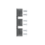 Kit VR FP XT6 3pcs thumbnail 3